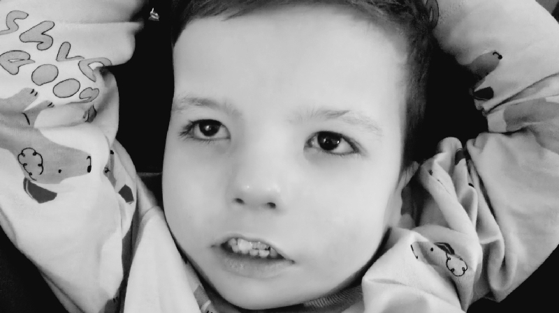 Close-up photograph of Teddy looking at the camera.